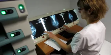 علاج واعد لسرطان الثدي يحقق نتائج مذهلة